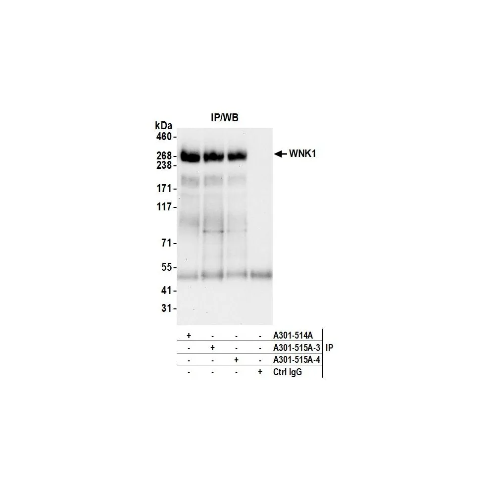 Rabbit anti-WNK1 Antibody, Affinity Purified
