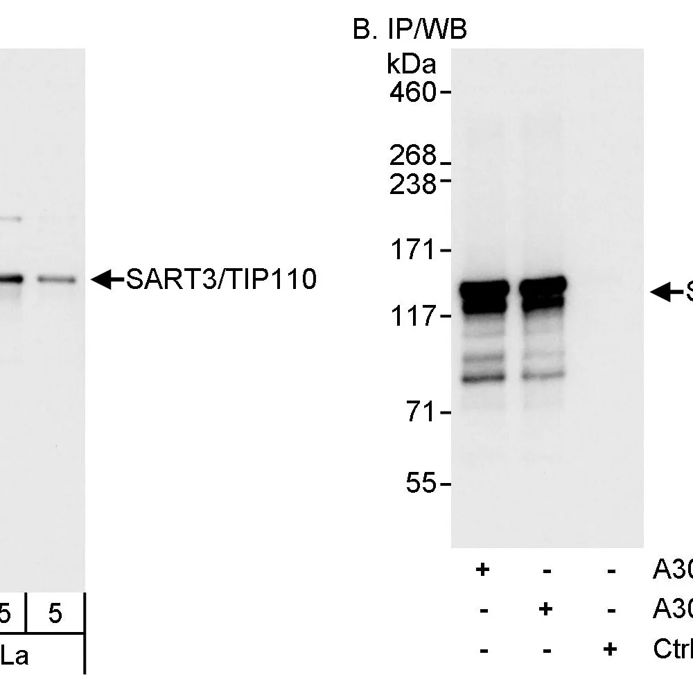 Rabbit anti-SART3/TIP110 Antibody, Affinity Purified