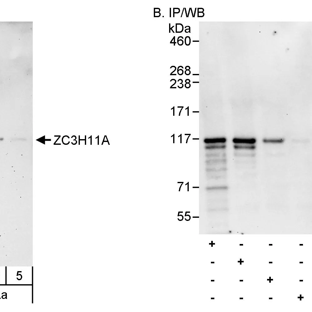 Rabbit anti-ZC3H11A Antibody, Affinity Purified