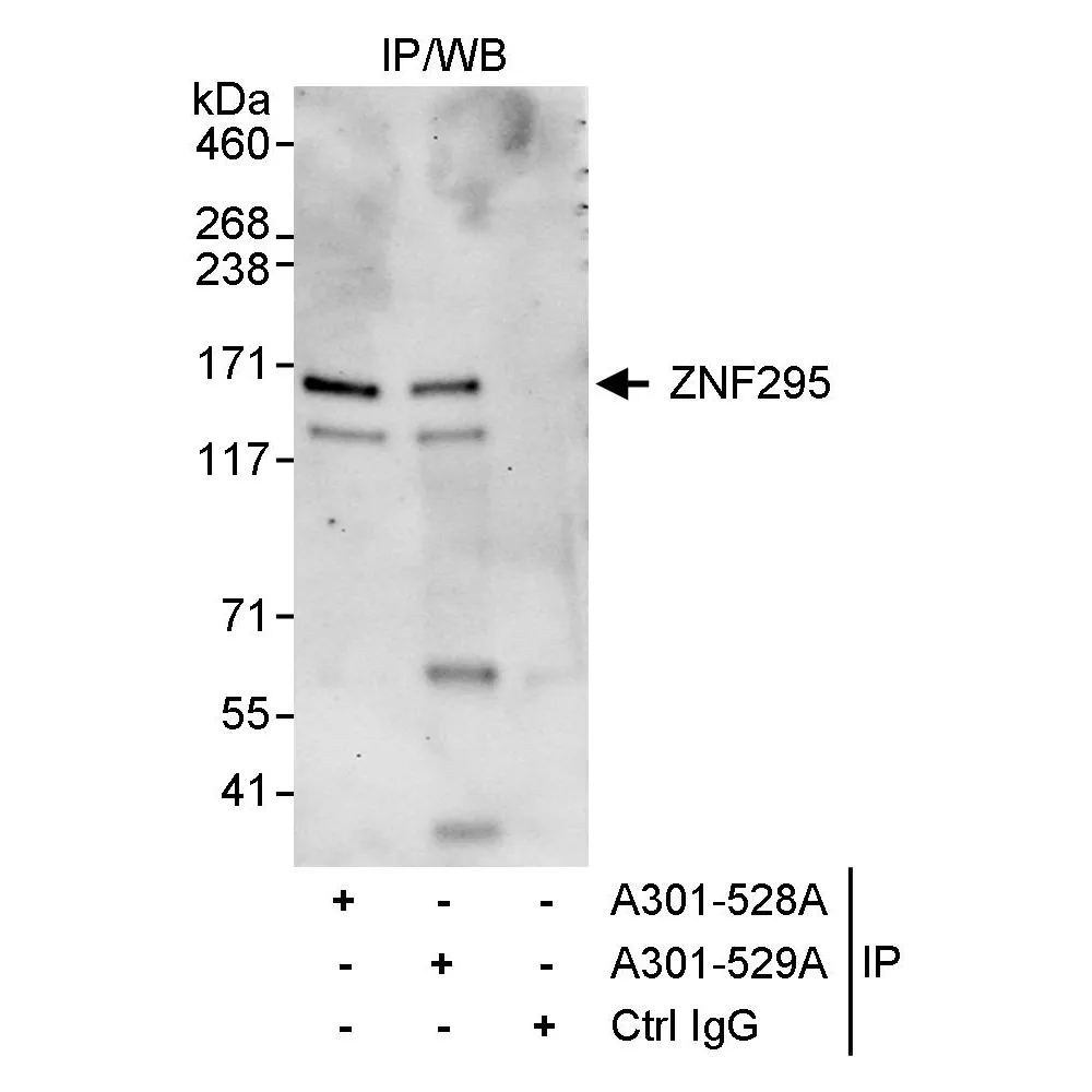 Rabbit anti-ZNF295 Antibody, Affinity Purified