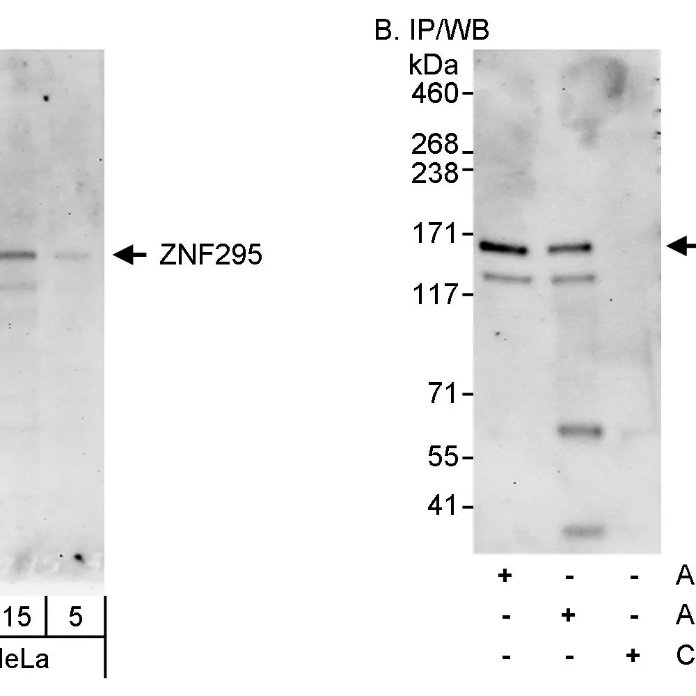 Rabbit anti-ZNF295 Antibody, Affinity Purified