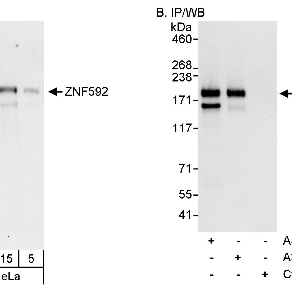 Rabbit anti-ZNF592 Antibody, Affinity Purified