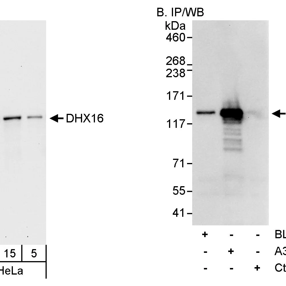 Rabbit anti-DHX16 Antibody, Affinity Purified