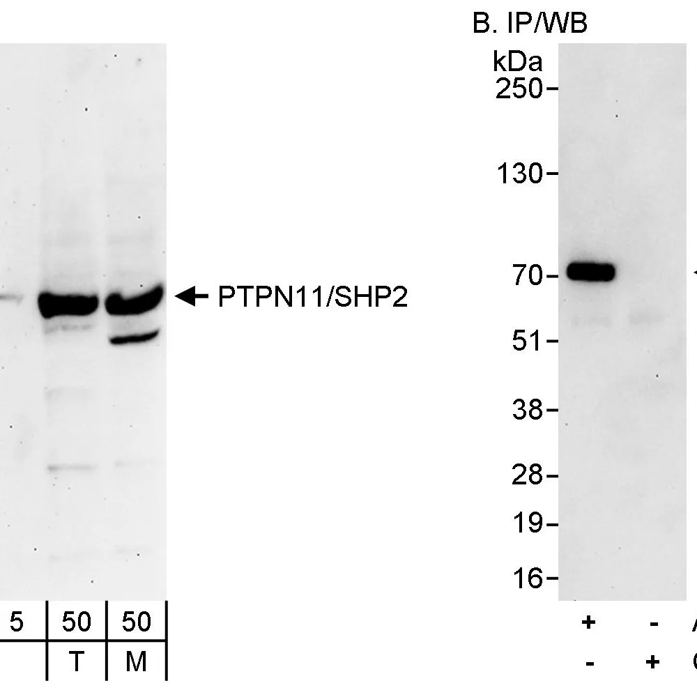 Rabbit anti-PTPN11/Shp2 Antibody, Affinity Purified