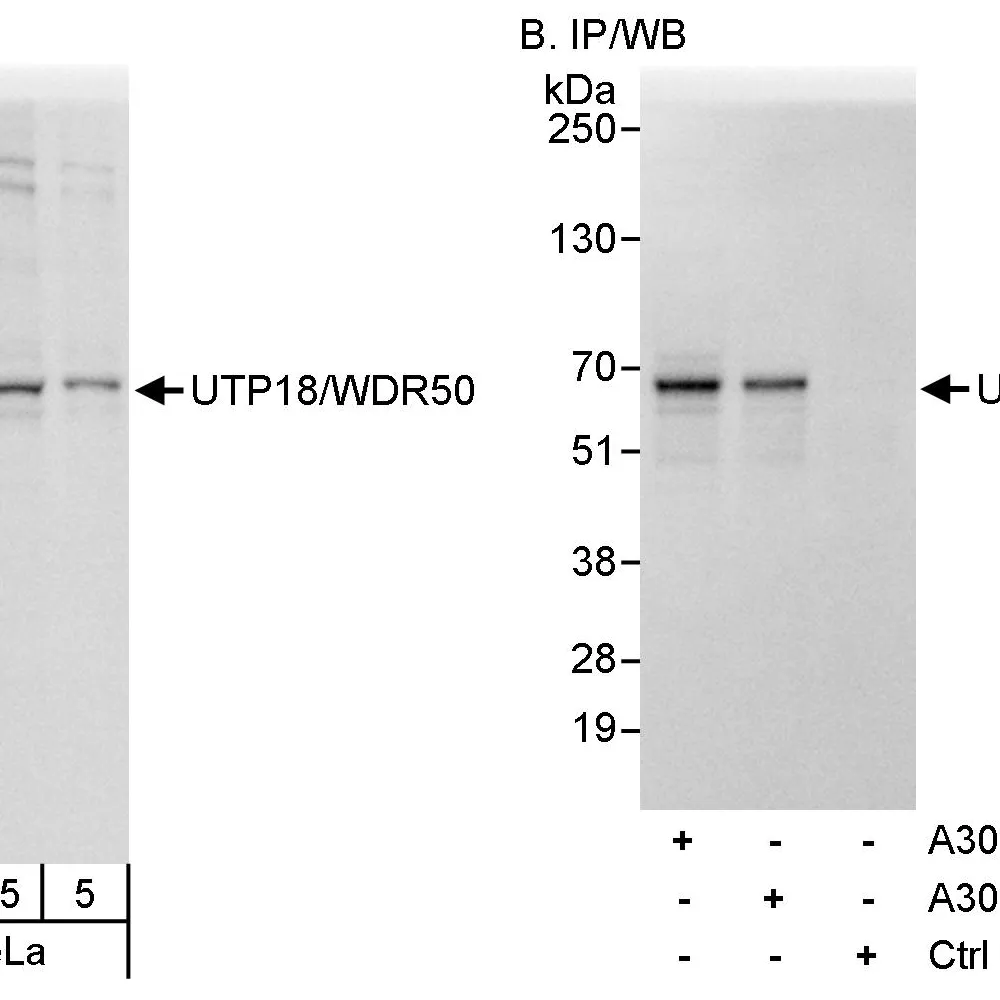 Rabbit anti-UTP18/WDR50 Antibody, Affinity Purified