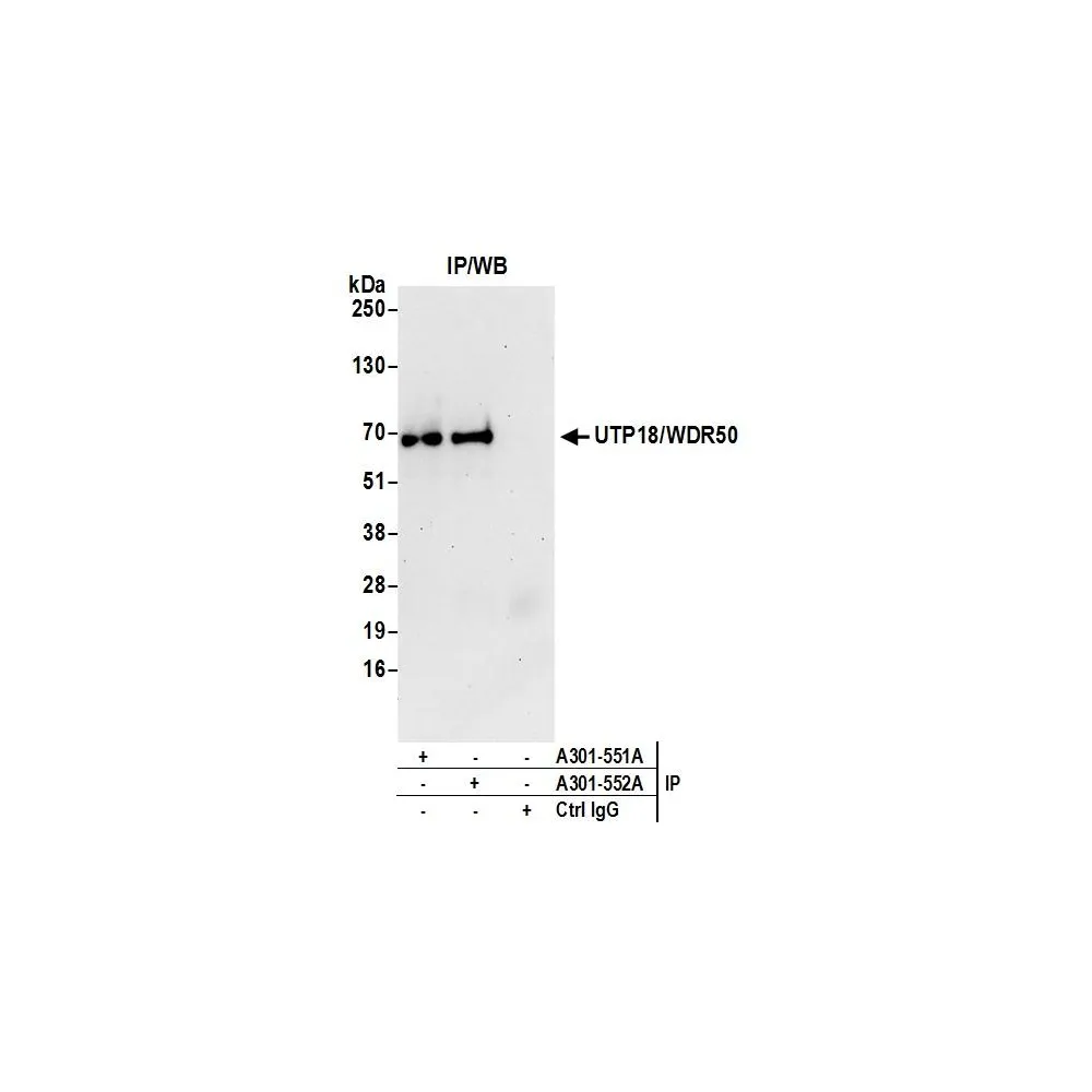 Rabbit anti-UTP18/WDR50 Antibody, Affinity Purified