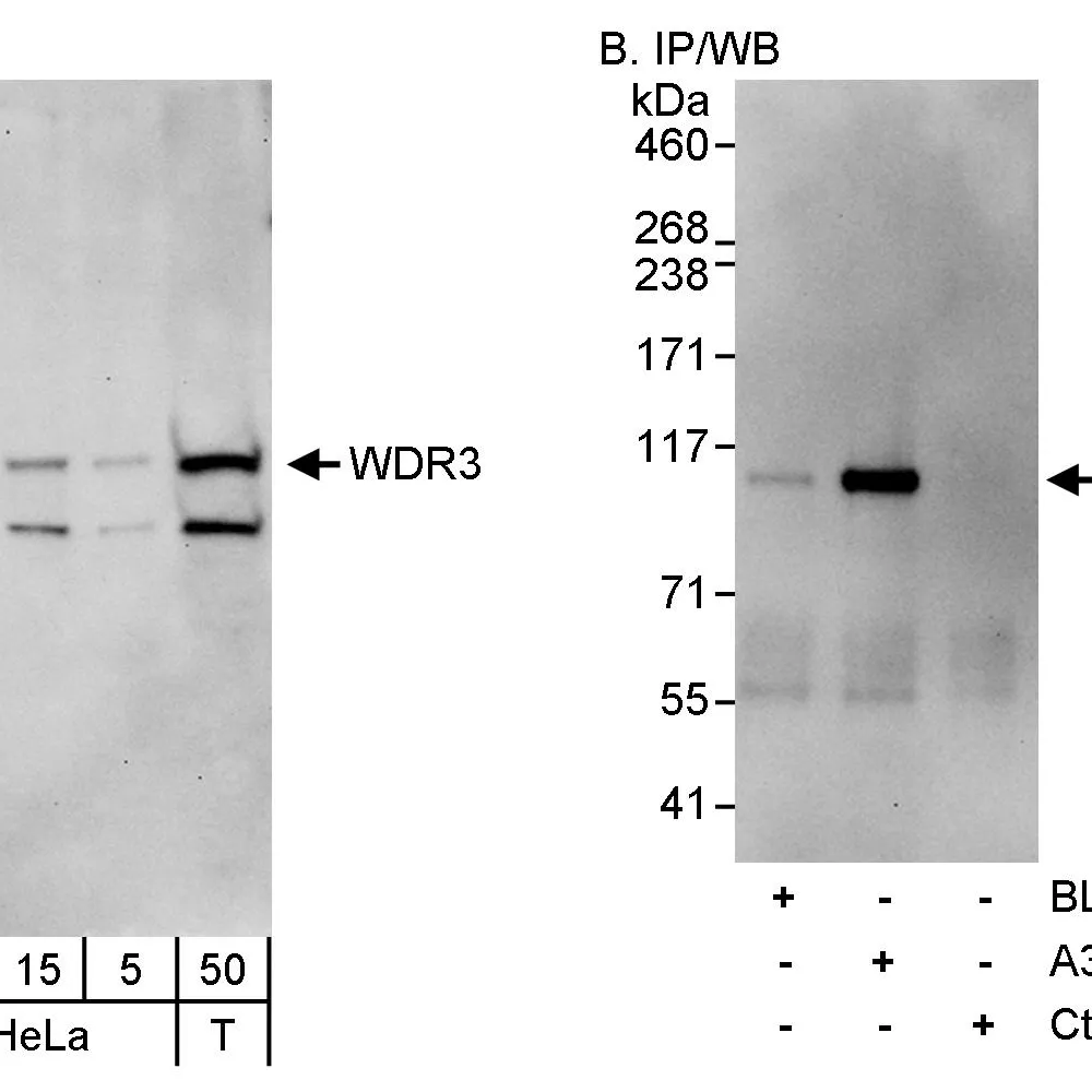 Rabbit anti-WDR3 Antibody, Affinity Purified