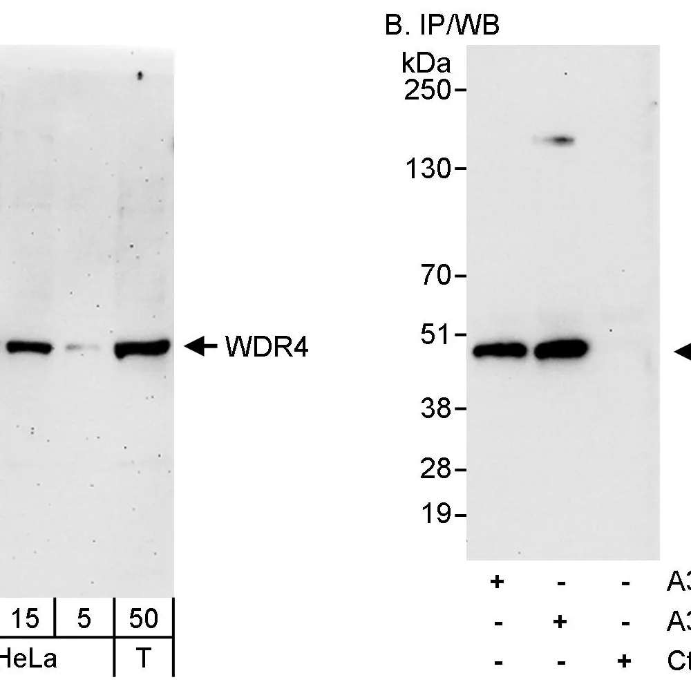 Rabbit anti-WDR4 Antibody, Affinity Purified