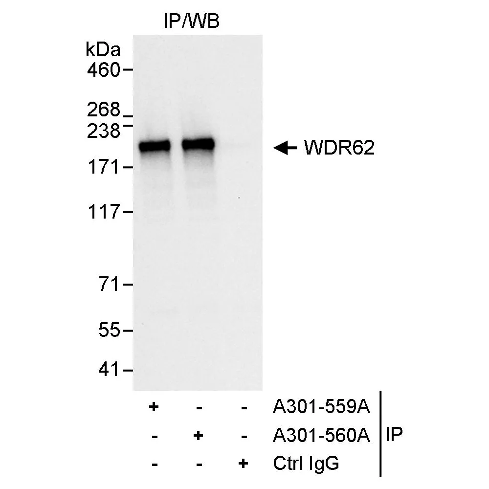 Rabbit anti-WDR62 Antibody, Affinity Purified