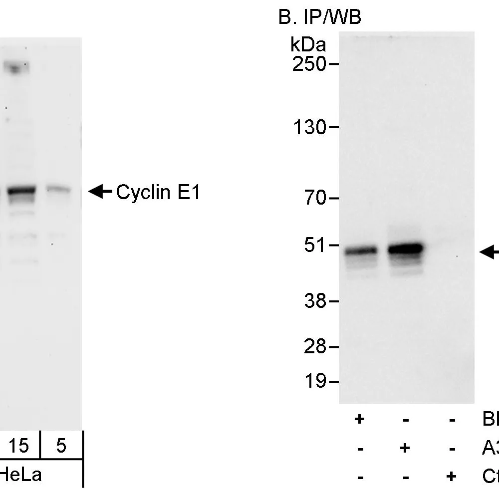 Rabbit anti-Cyclin E1 Antibody, Affinity Purified