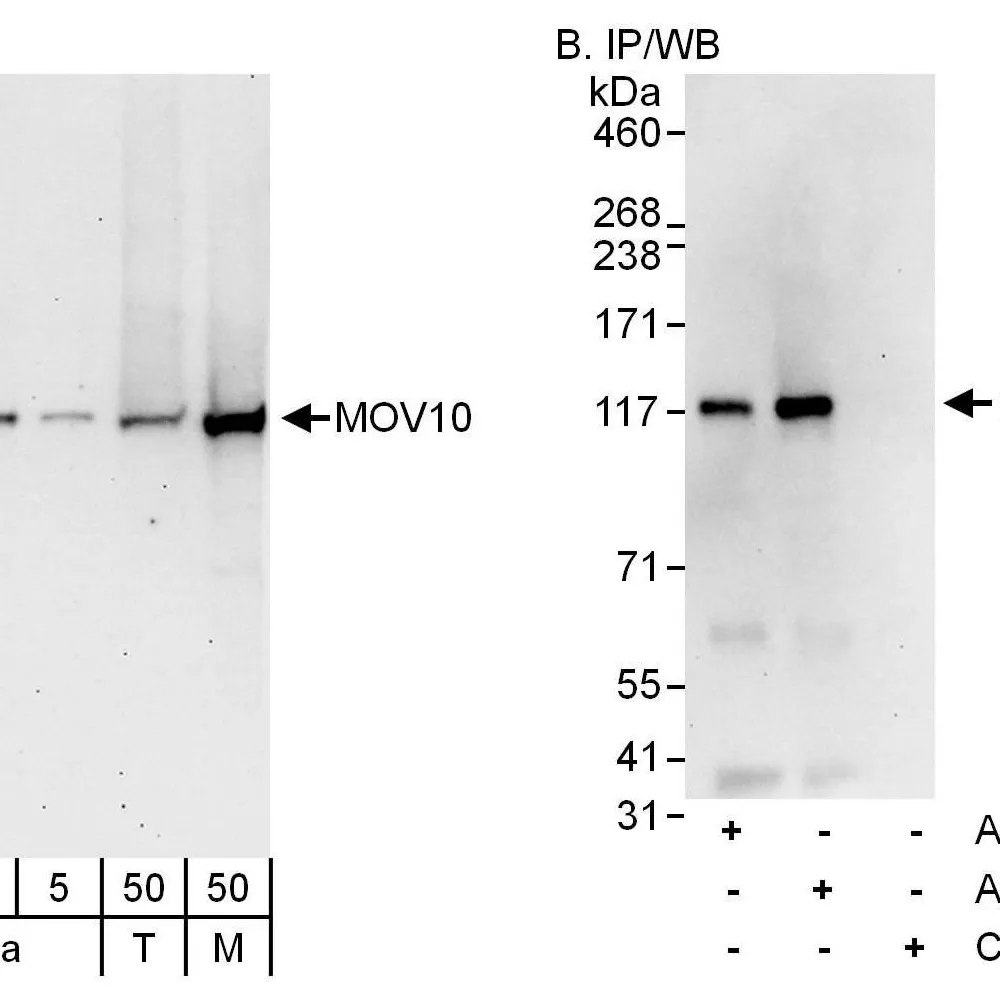 Rabbit anti-MOV10 Antibody, Affinity Purified