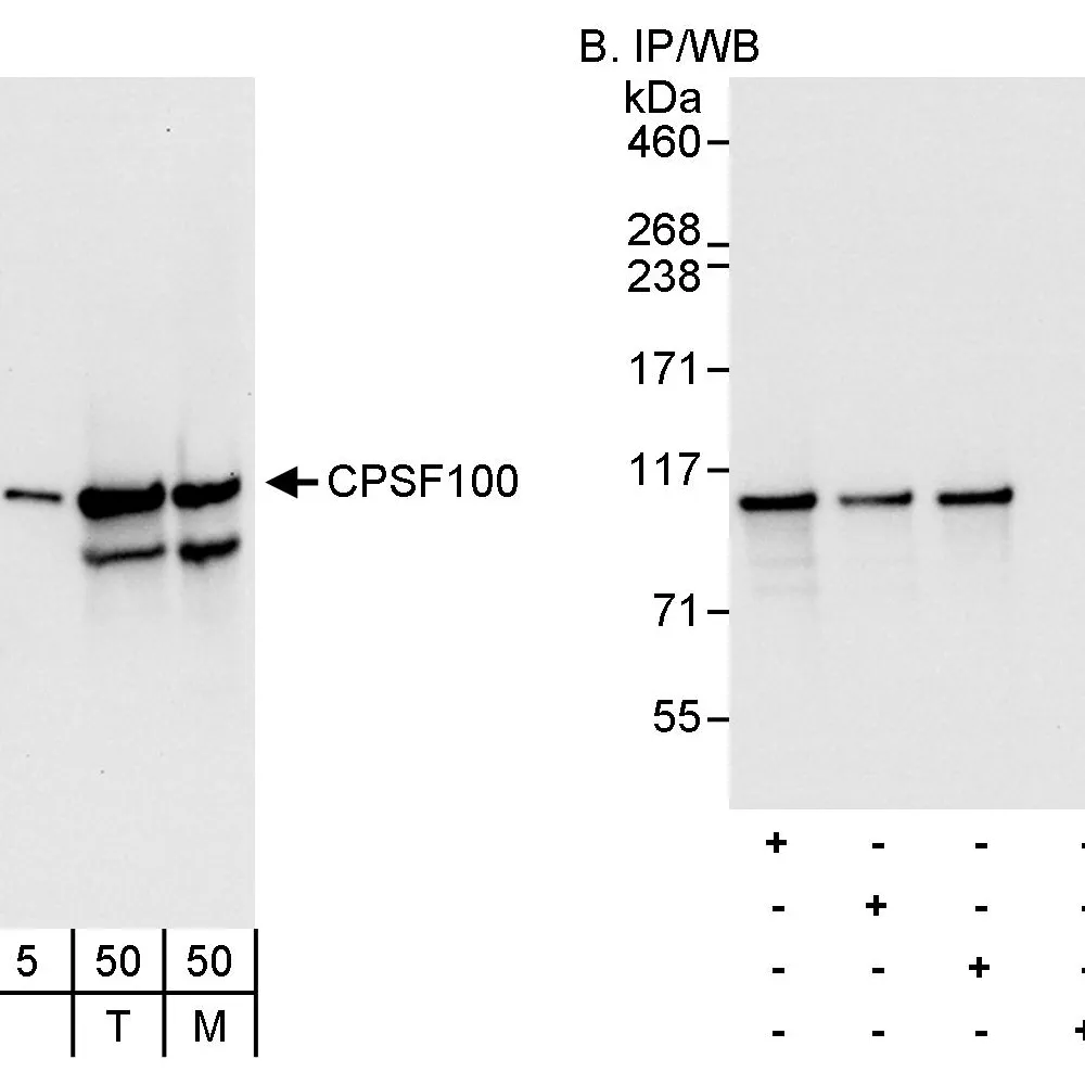 Rabbit anti-CPSF100 Antibody, Affinity Purified