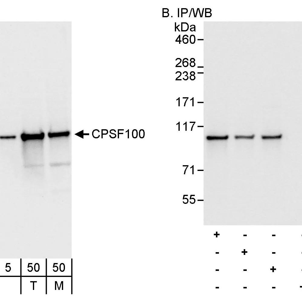 Rabbit anti-CPSF100 Antibody, Affinity Purified