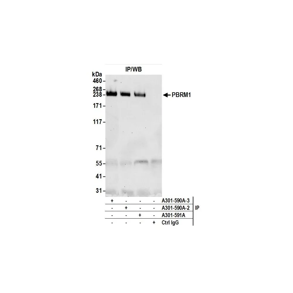 Rabbit anti-PBRM1 Antibody, Affinity Purified