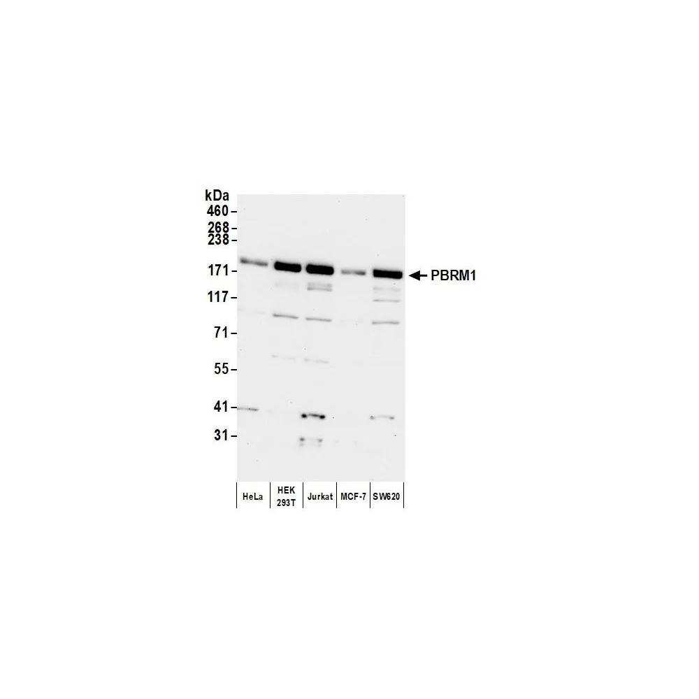 Rabbit anti-PBRM1 Antibody, Affinity Purified