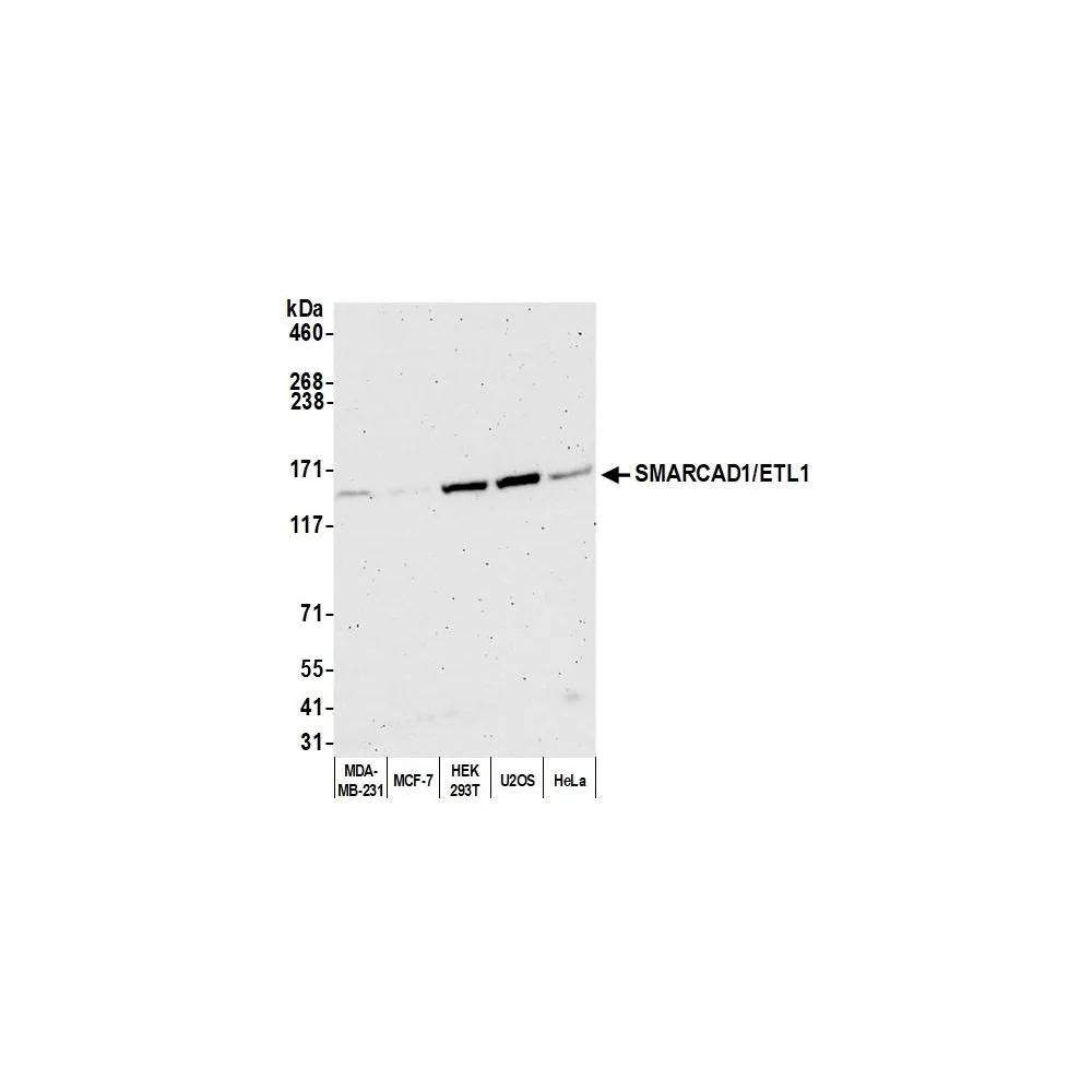 Rabbit anti-SMARCAD1/ETL1 Antibody, Affinity Purified