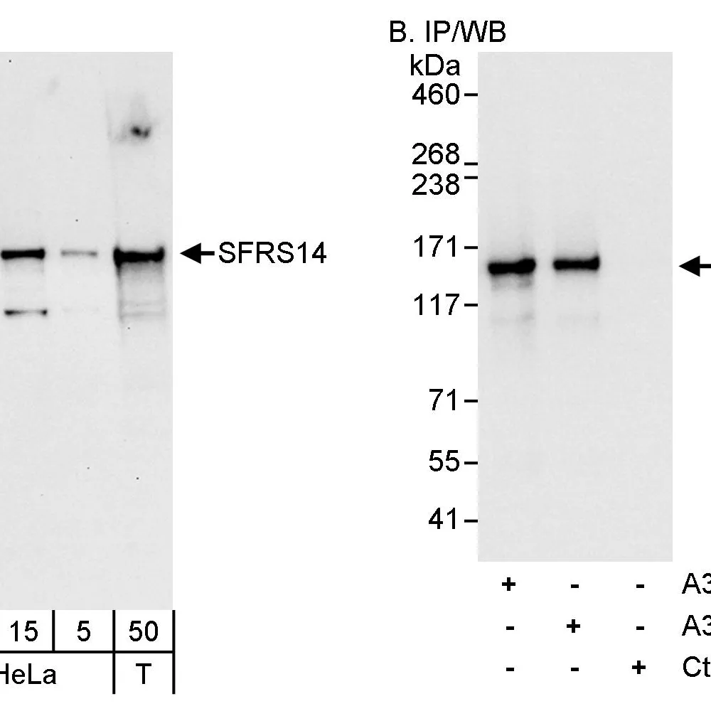 Rabbit anti-SFRS14 Antibody, Affinity Purified
