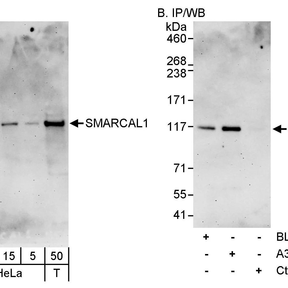 Rabbit anti-SMARCAL1 Antibody, Affinity Purified