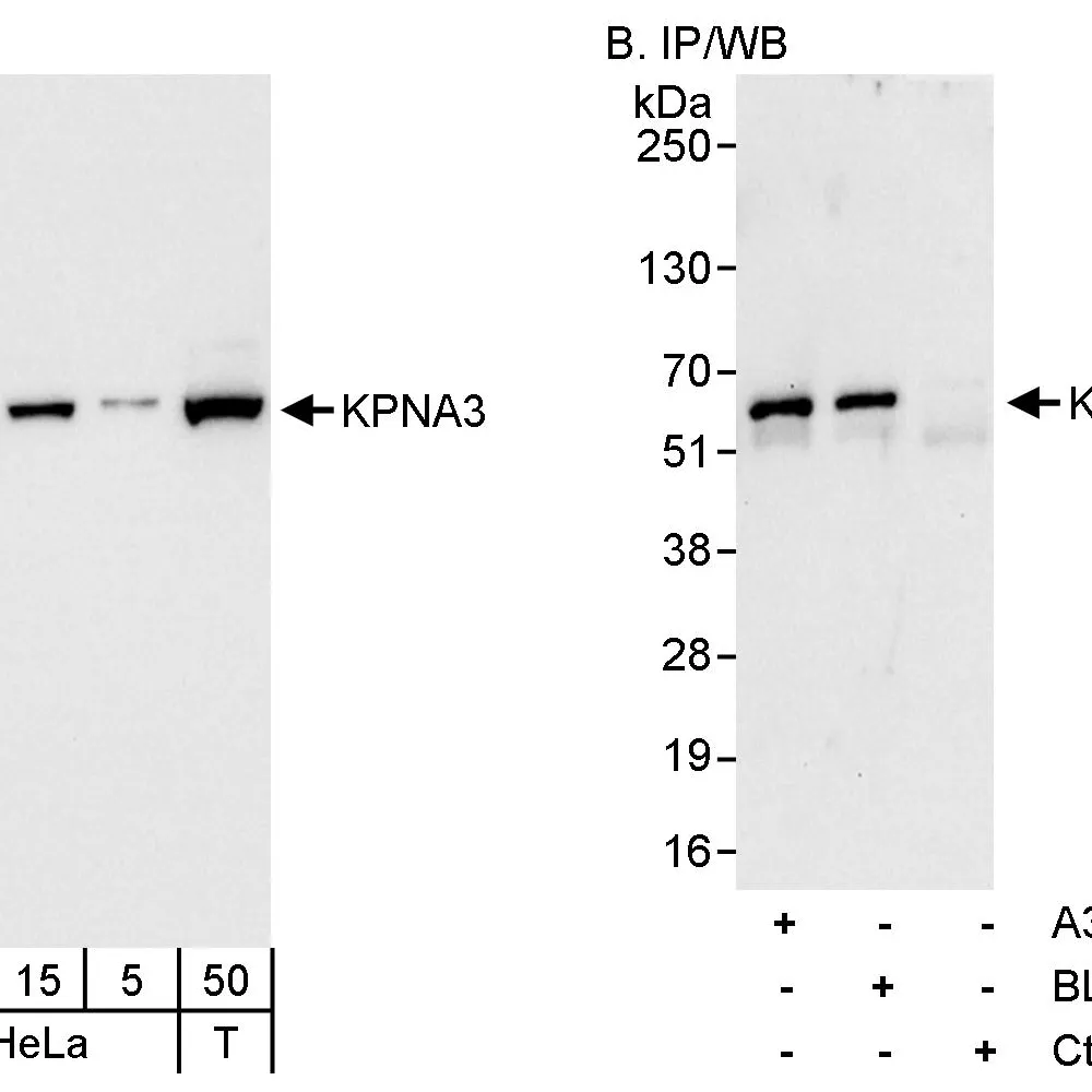Rabbit anti-KPNA3 Antibody, Affinity Purified