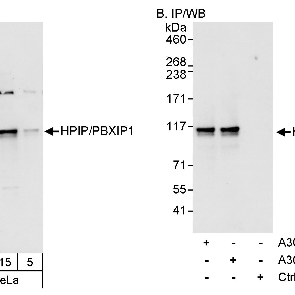 Rabbit anti-HPIP Antibody, Affinity Purified