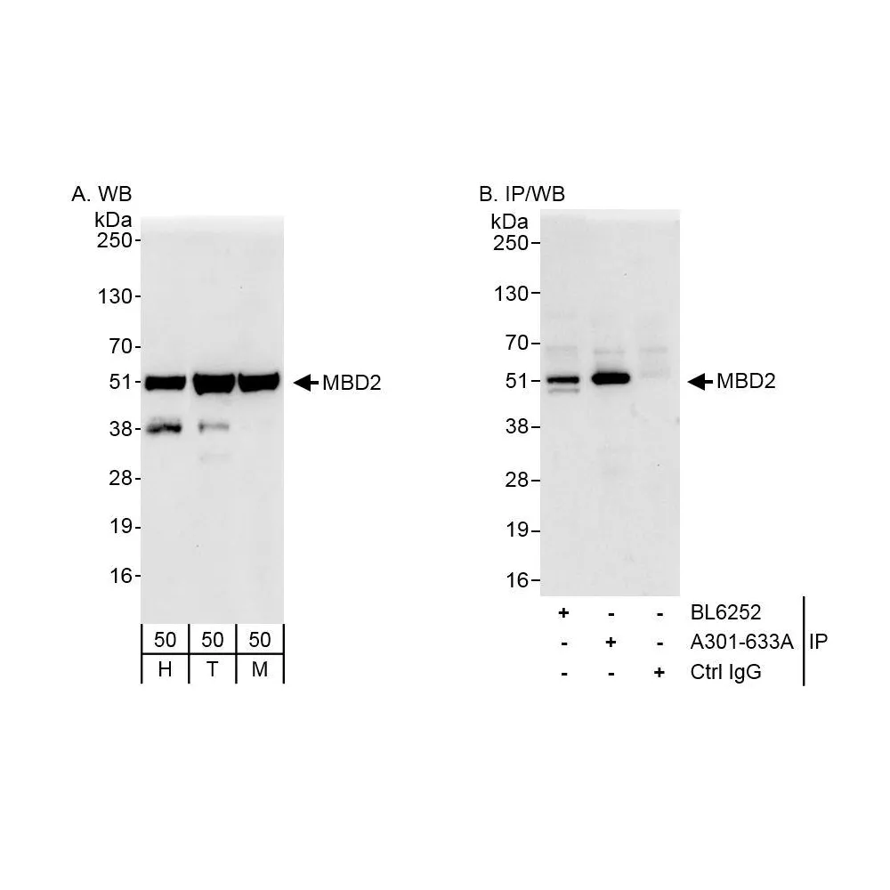 Rabbit anti-MBD2 Antibody, Affinity Purified