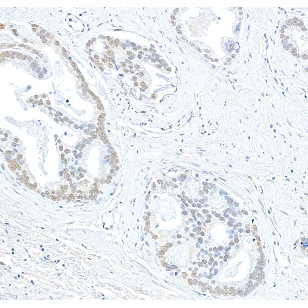 Rabbit anti-EHMT1 Antibody, Affinity Purified