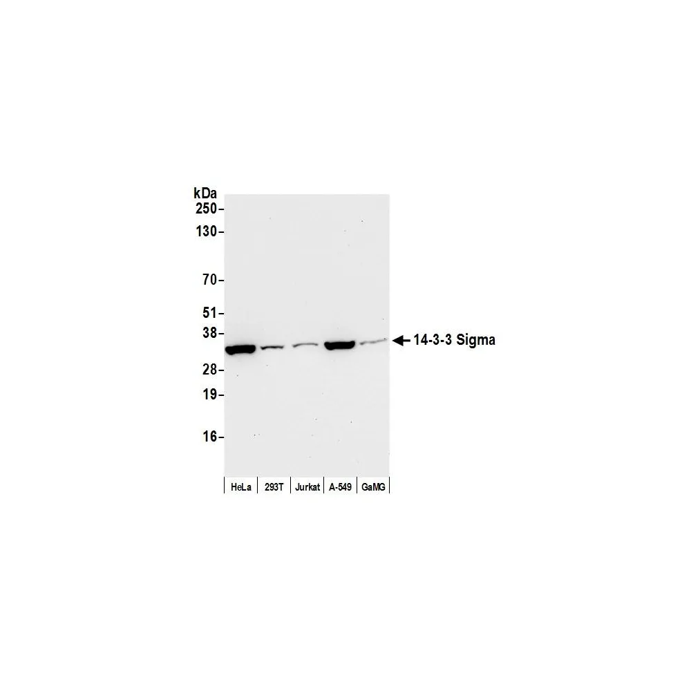 Rabbit anti-14-3-3 Sigma Antibody, Affinity Purified