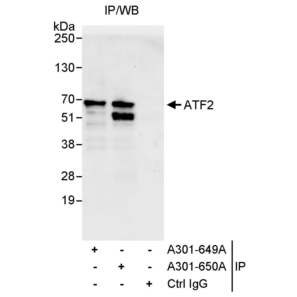 Rabbit anti-ATF2 Antibody, Affinity Purified
