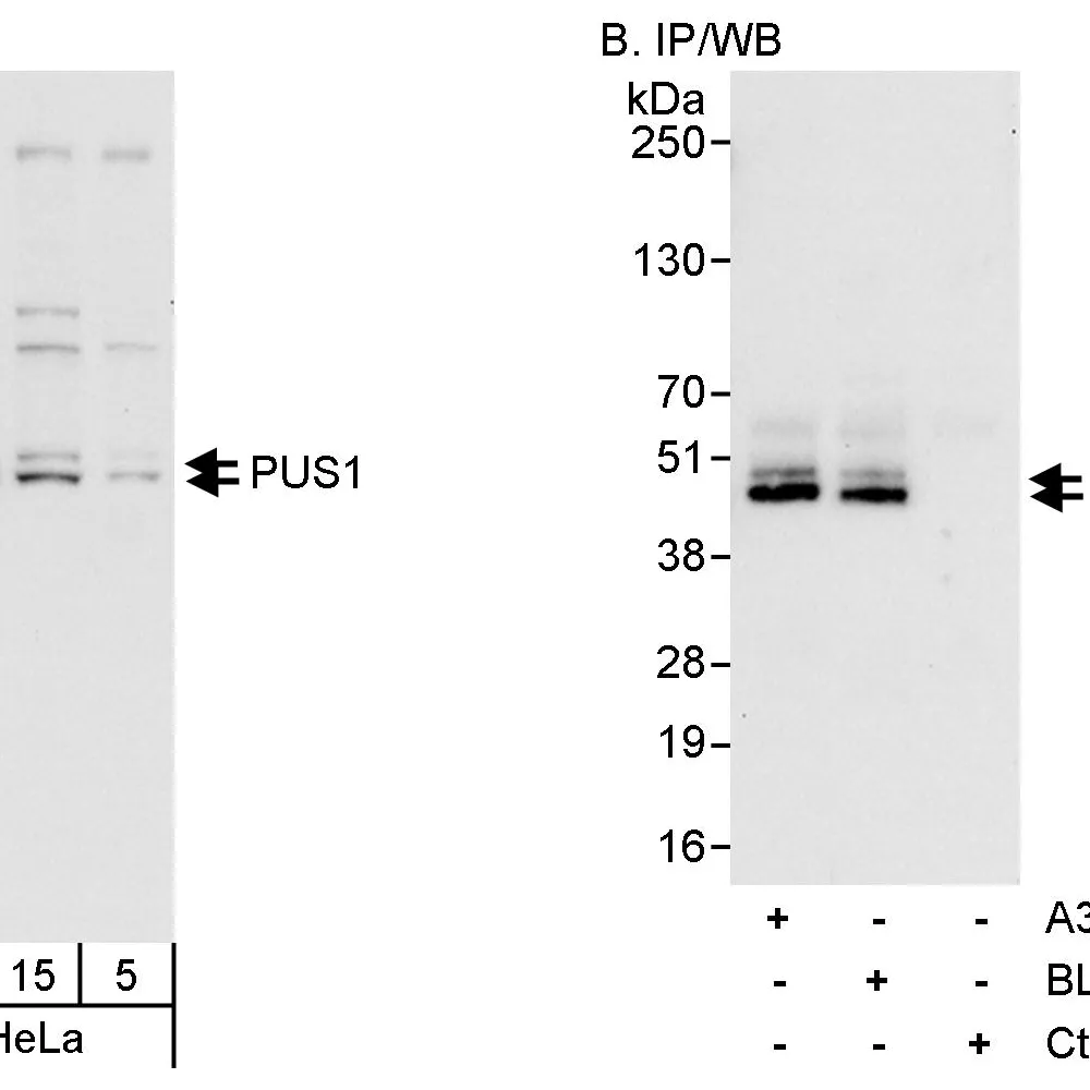 Rabbit anti-PUS1 Antibody, Affinity Purified