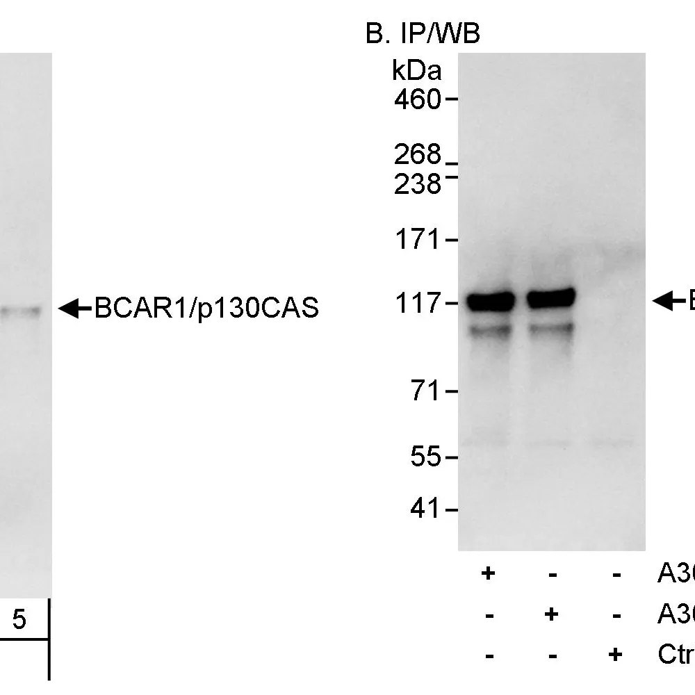 Rabbit anti-BCAR1/p130CAS Antibody, Affinity Purified