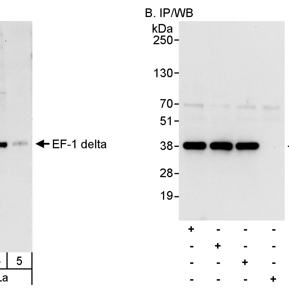 Rabbit anti-EF-1 delta Antibody, Affinity Purified
