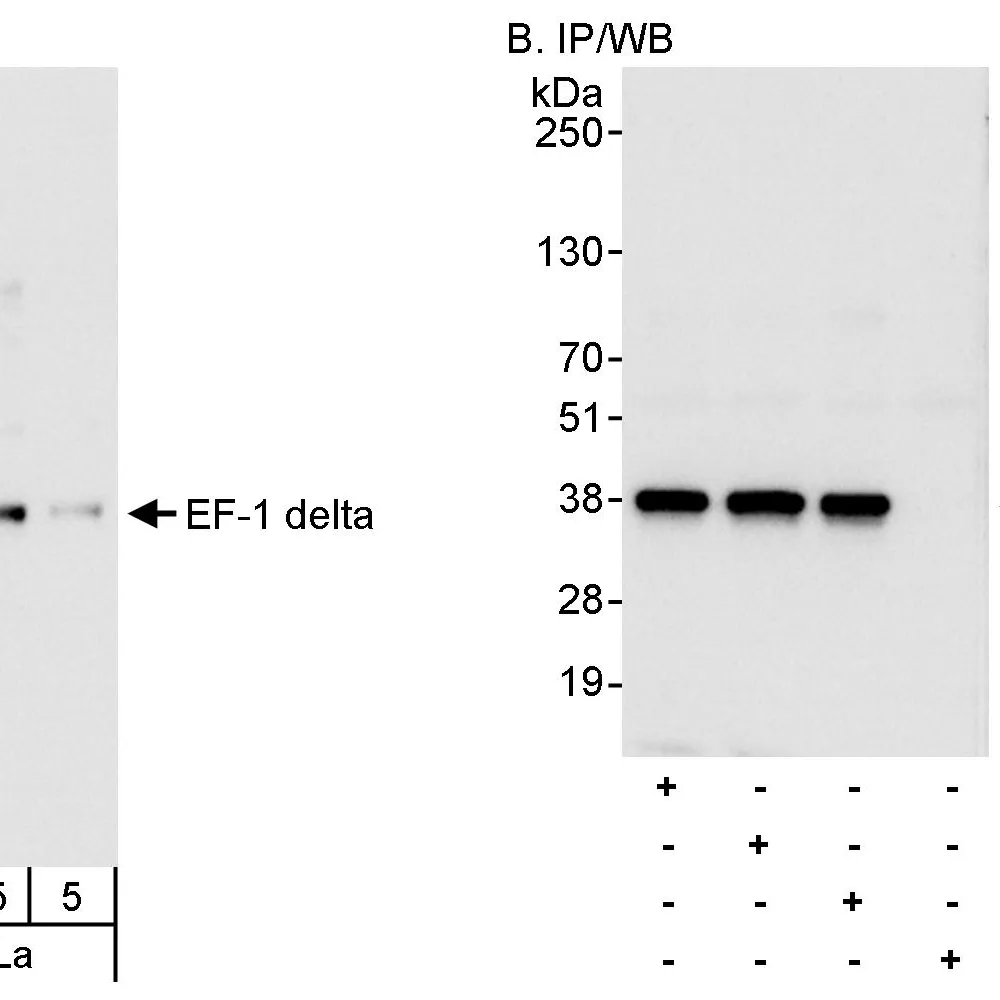 Rabbit anti-EF-1 delta Antibody, Affinity Purified