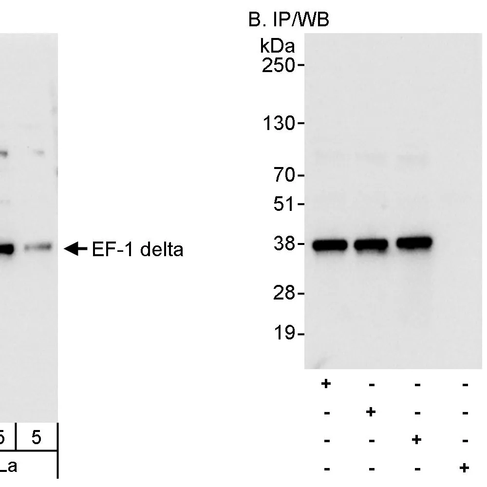 Rabbit anti-EF-1 delta Antibody, Affinity Purified