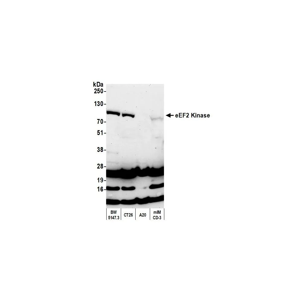 Rabbit anti-eEF2 Kinase Antibody, Affinity Purified