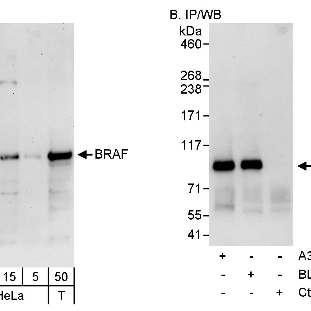 Rabbit anti-BRAF Antibody, Affinity Purified