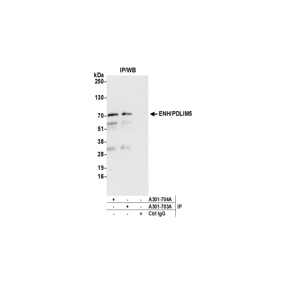 Rabbit anti-ENH/PDLIM5 Antibody, Affinity Purified