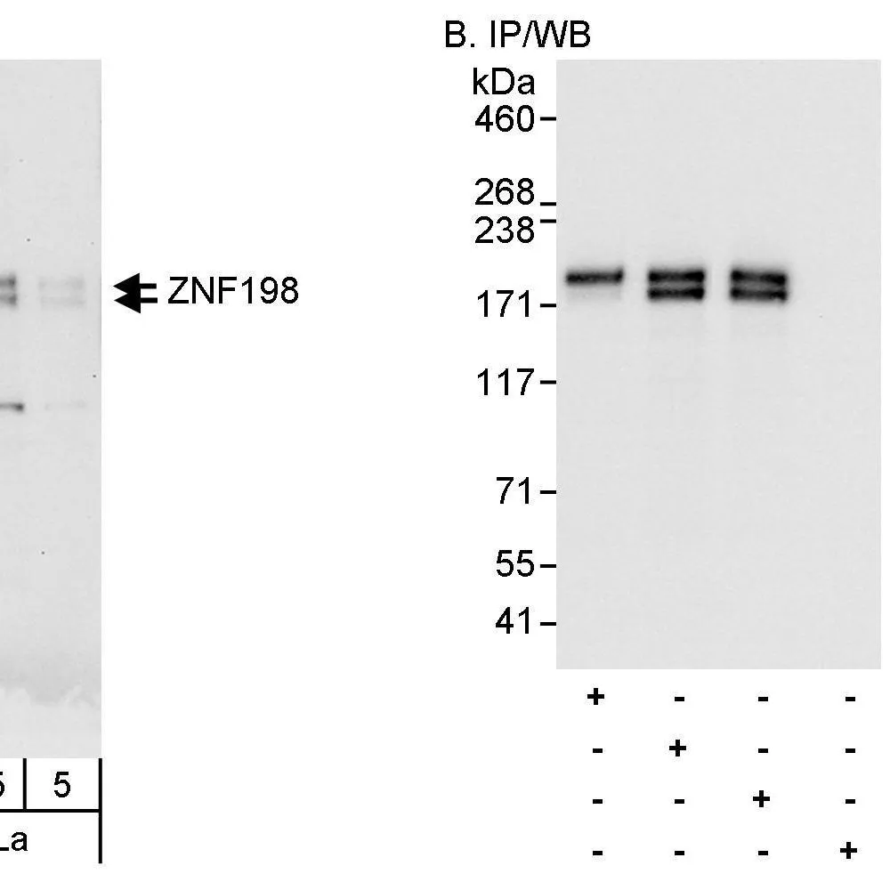 Rabbit anti-ZNF198 Antibody, Affinity Purified