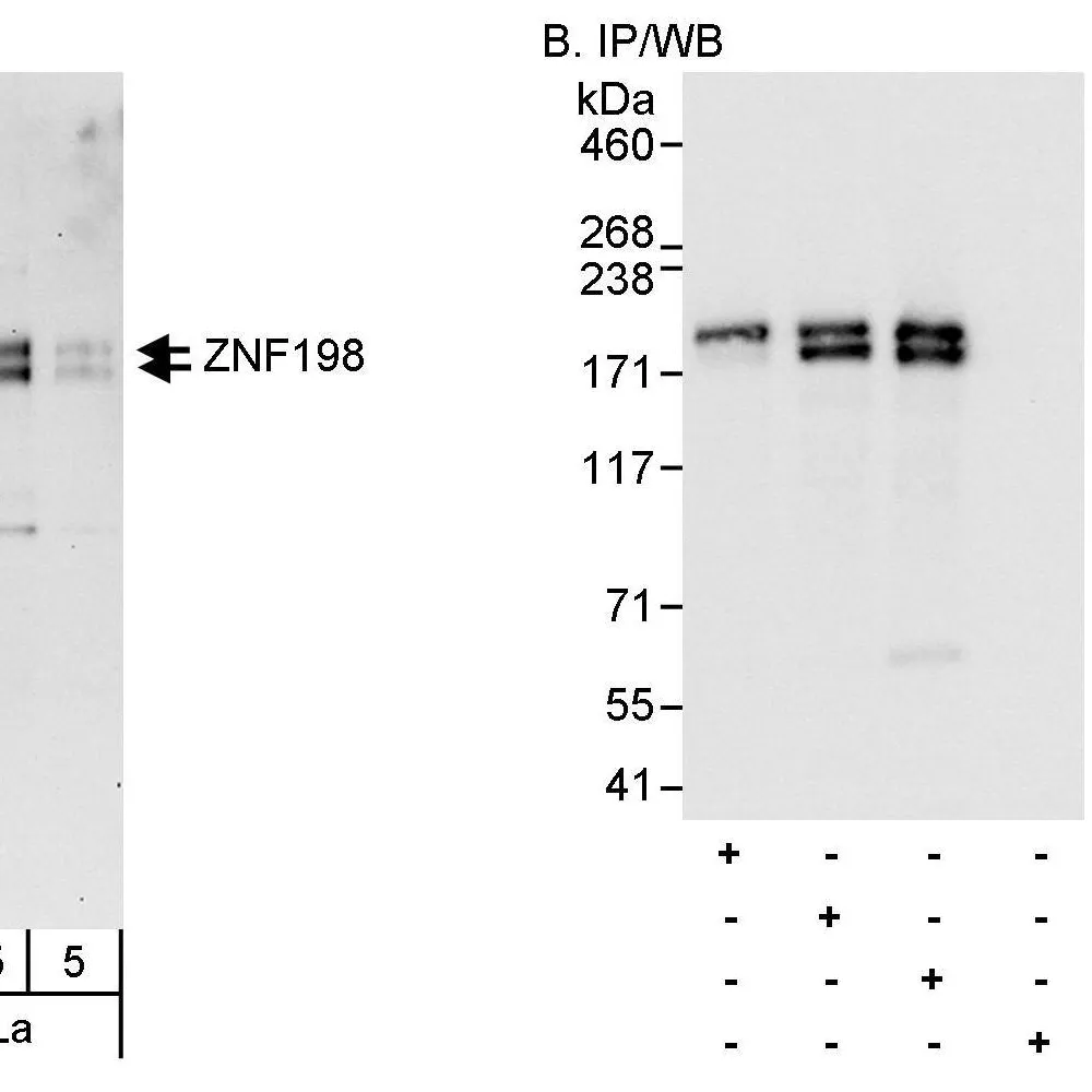 Rabbit anti-ZNF198 Antibody, Affinity Purified