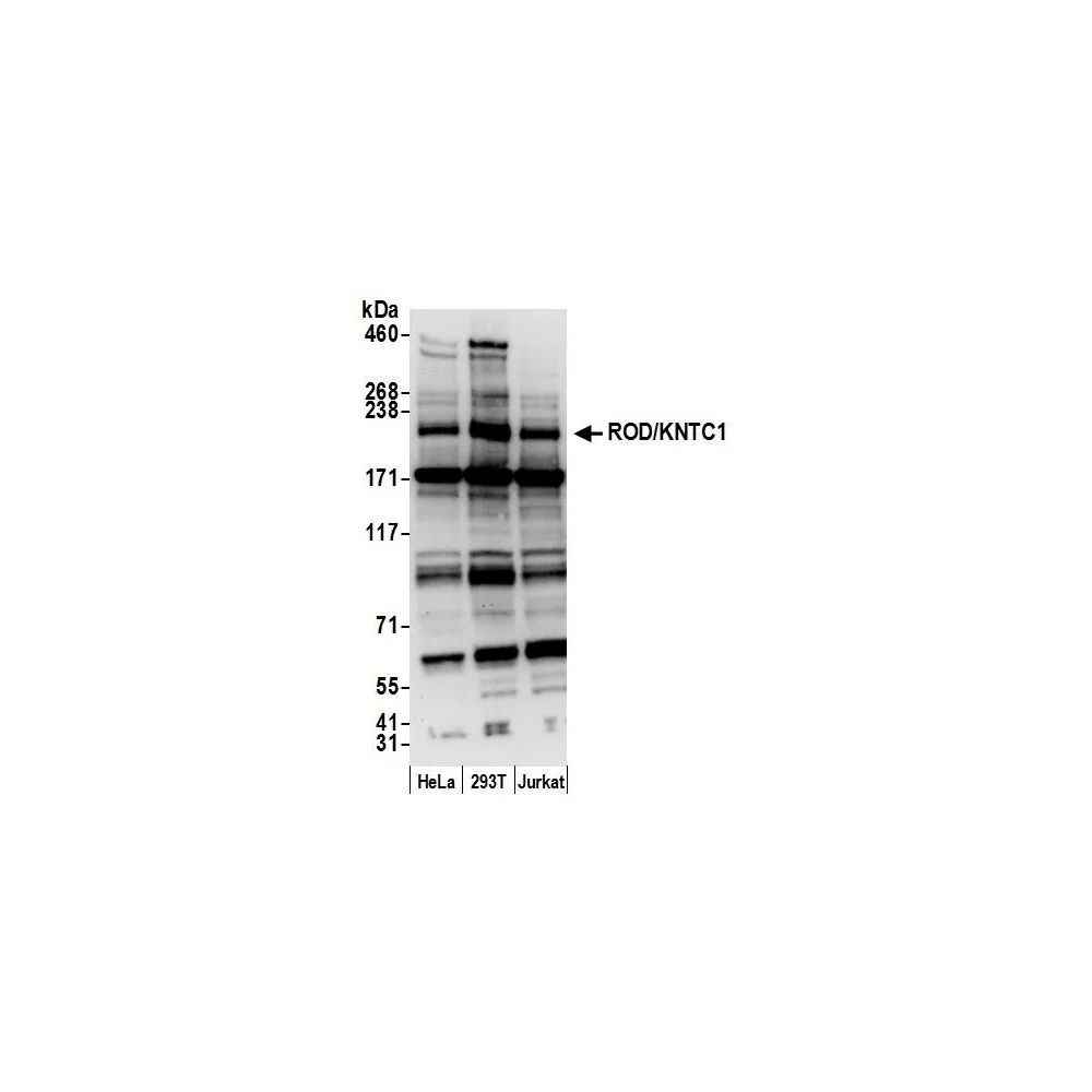 Rabbit anti-ROD/KNTC1 Antibody, Affinity Purified