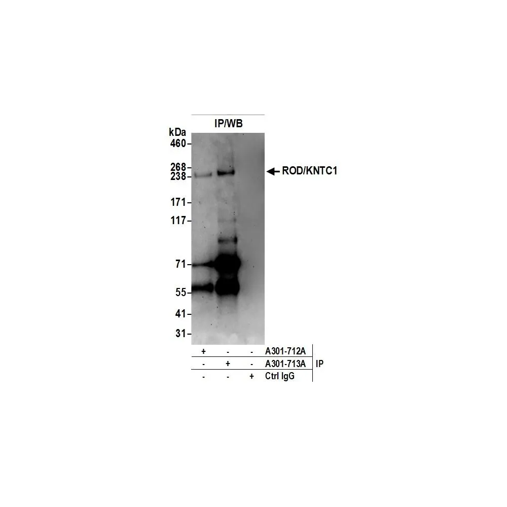Rabbit anti-ROD/KNTC1 Antibody, Affinity Purified