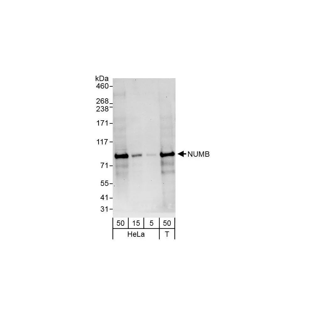 Rabbit anti-NUMB Antibody, Affinity Purified