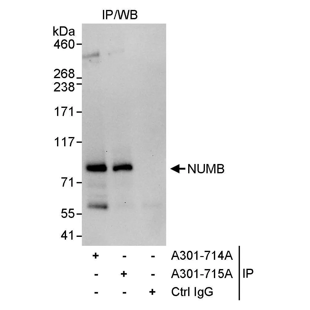 Rabbit anti-NUMB Antibody, Affinity Purified