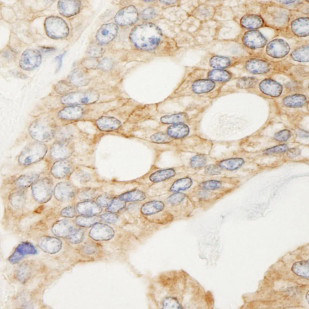 Rabbit anti-Filamin B Antibody, Affinity Purified