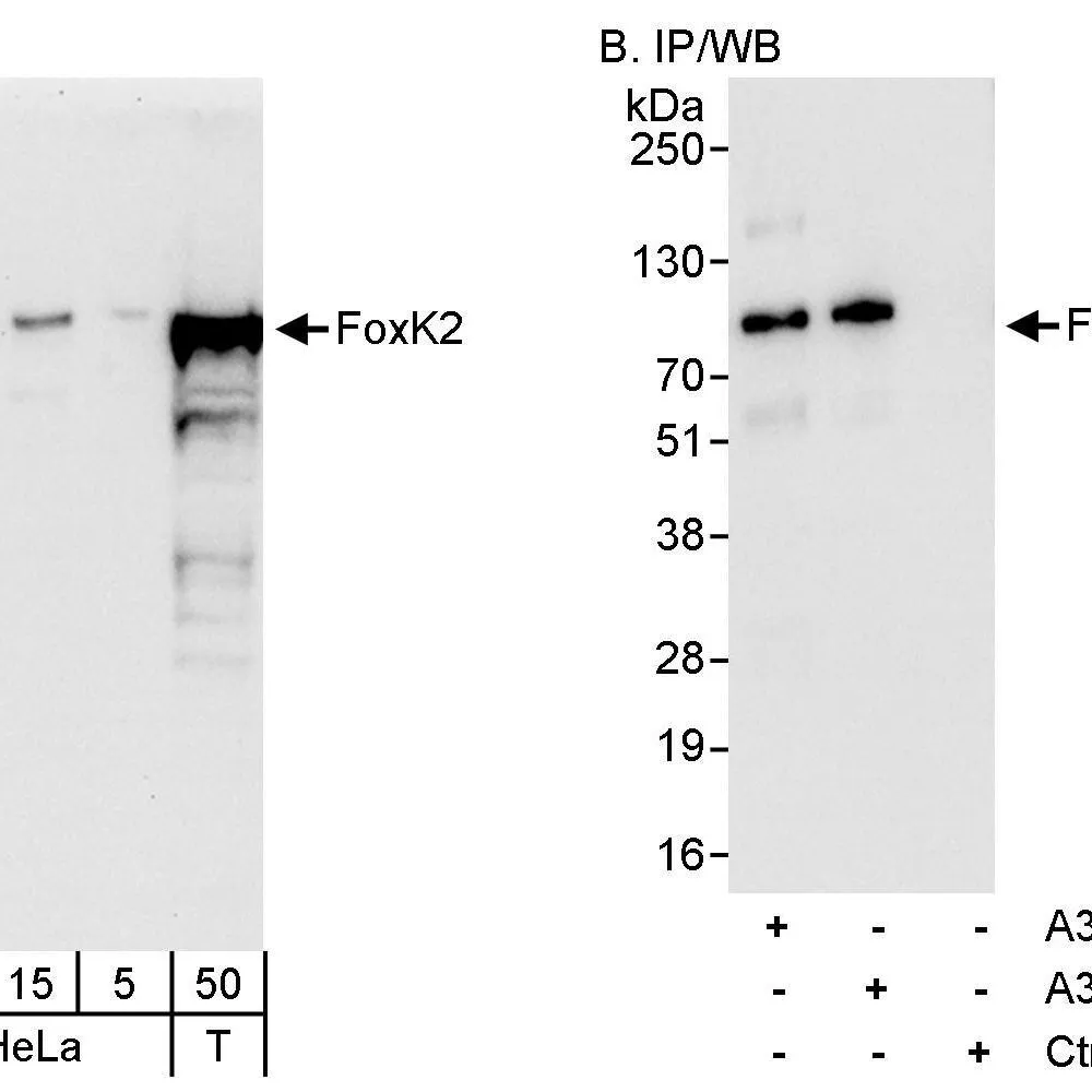 Rabbit anti-FOXK2 Antibody, Affinity Purified