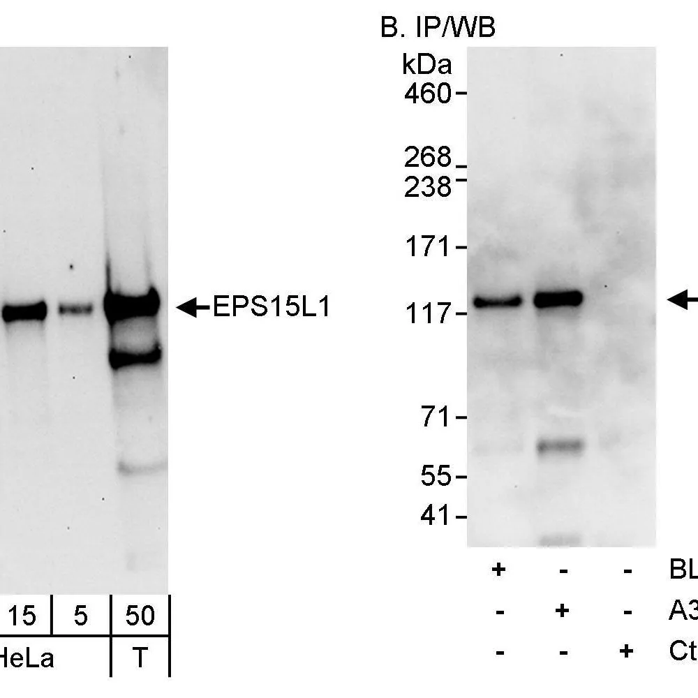 Rabbit anti-EPS15L Antibody, Affinity Purified