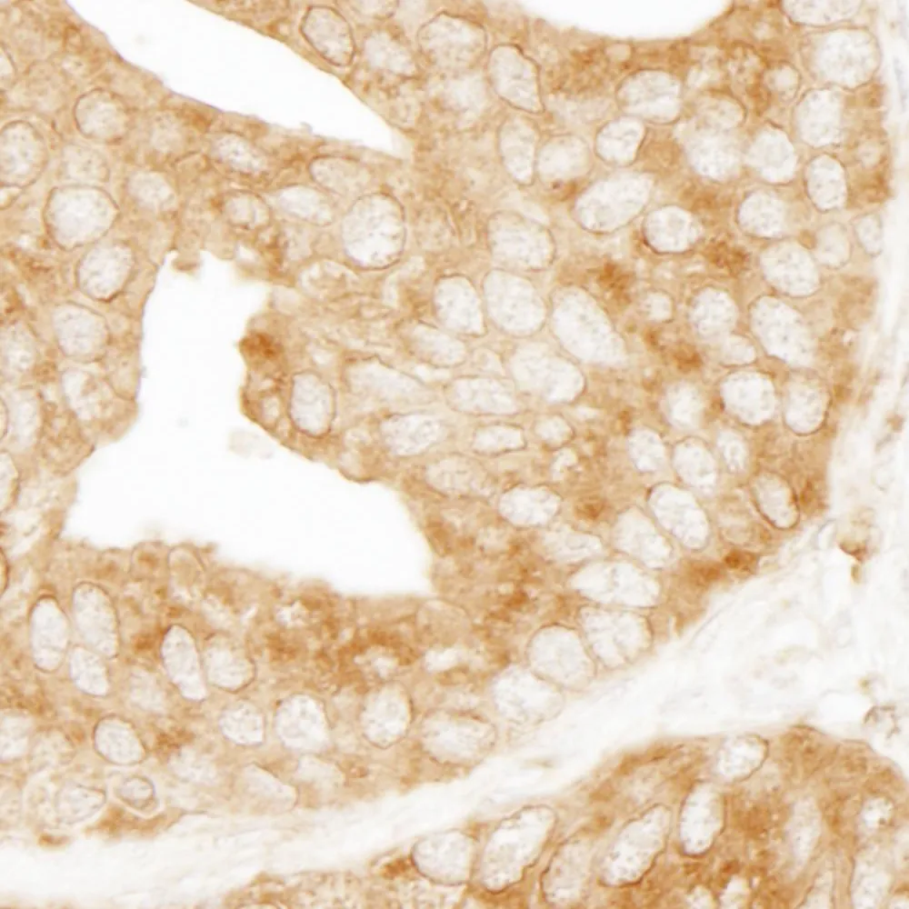 Rabbit anti-EPS15 Antibody, Affinity Purified