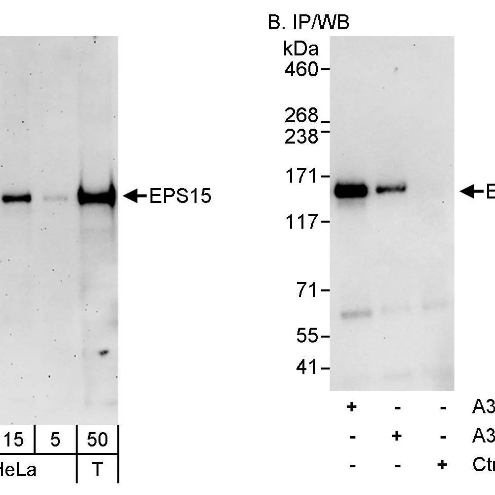 Rabbit anti-EPS15 Antibody, Affinity Purified