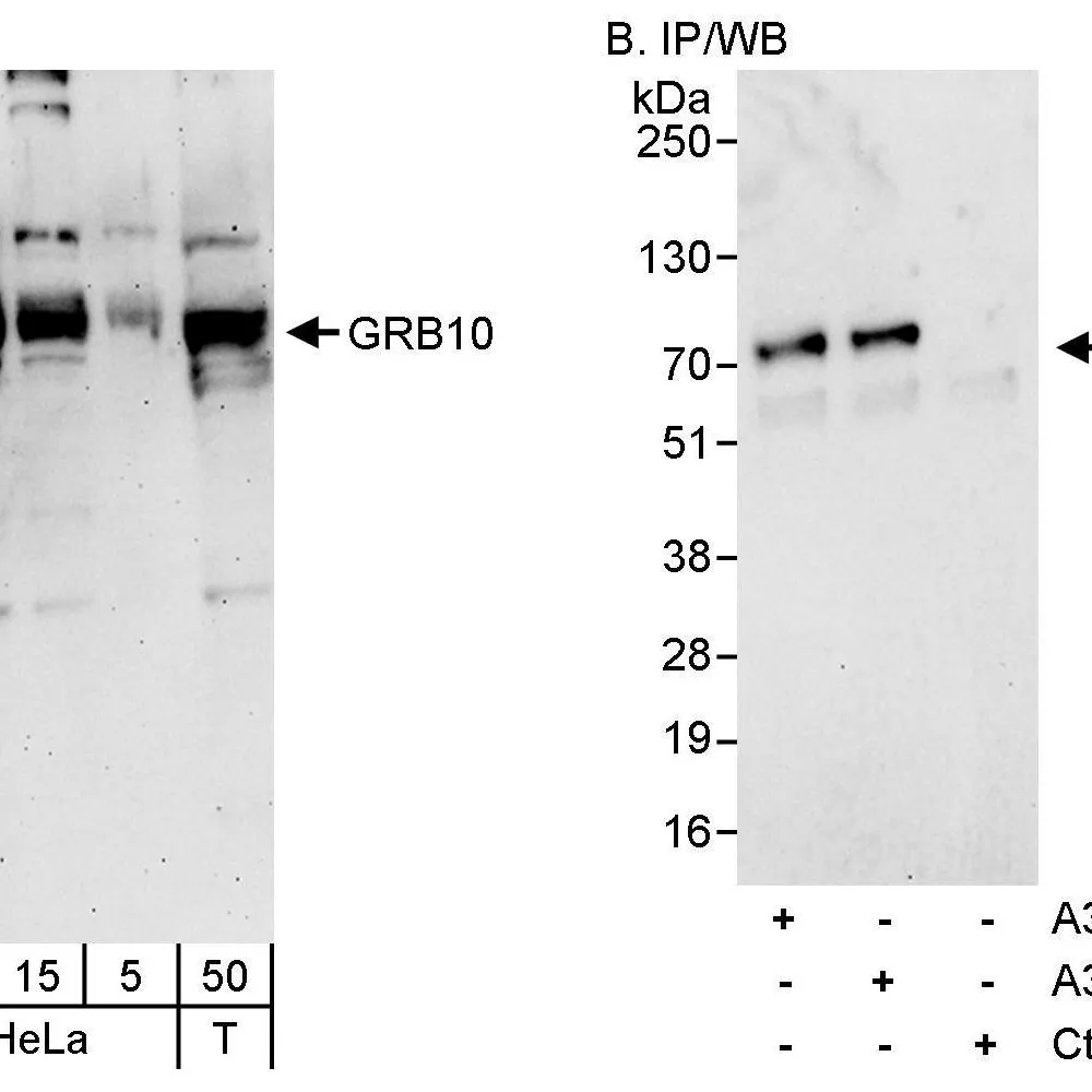 Rabbit anti-GRB10 Antibody, Affinity Purified