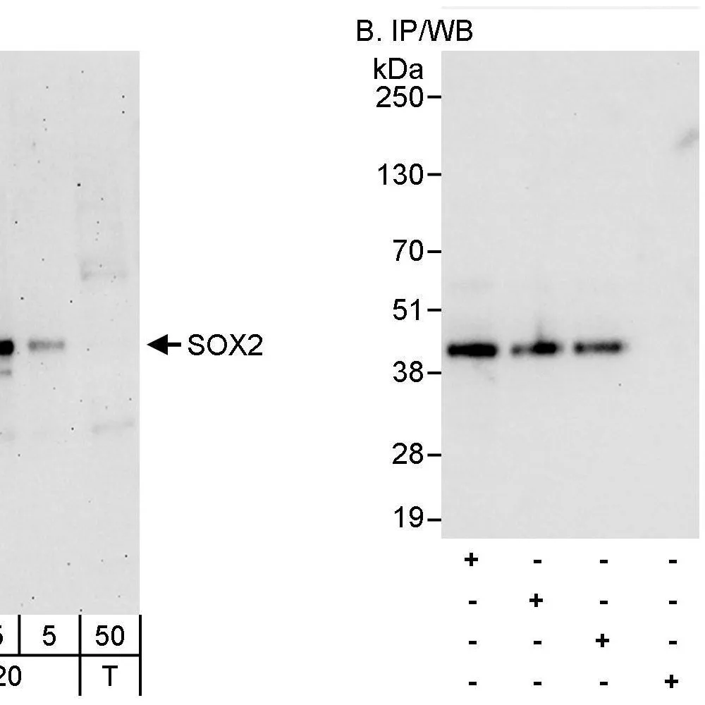 Rabbit anti-SOX2 Antibody, Affinity Purified