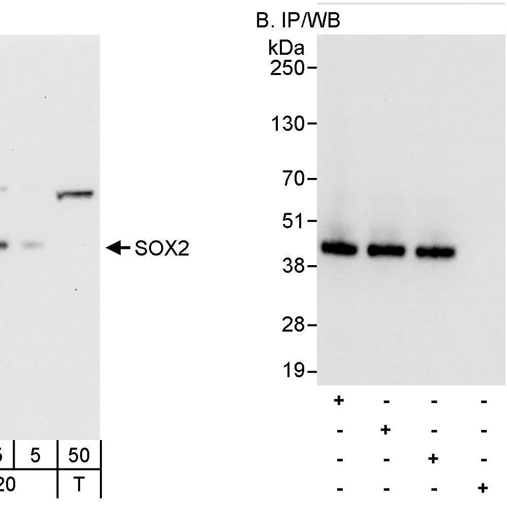Rabbit anti-SOX2 Antibody, Affinity Purified